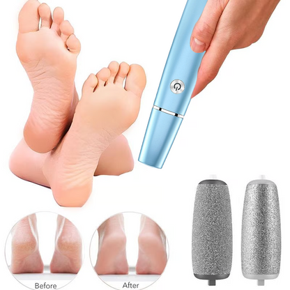 🔥Mother's Day Hot Sale 50%🔥⚡Electric Feet Callus Remover
