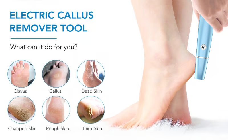 🔥Mother's Day Hot Sale 50%🔥⚡Electric Feet Callus Remover