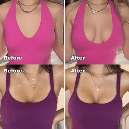🔥LAST DAY SALE ONLY ￡7.99!!💕OUFALI Lift Inserts for Bras – Lightly Padded, Double-Sided Adhesive👙 Reusable, Washable • Natural Lift • Seamless Under Clothing ✨