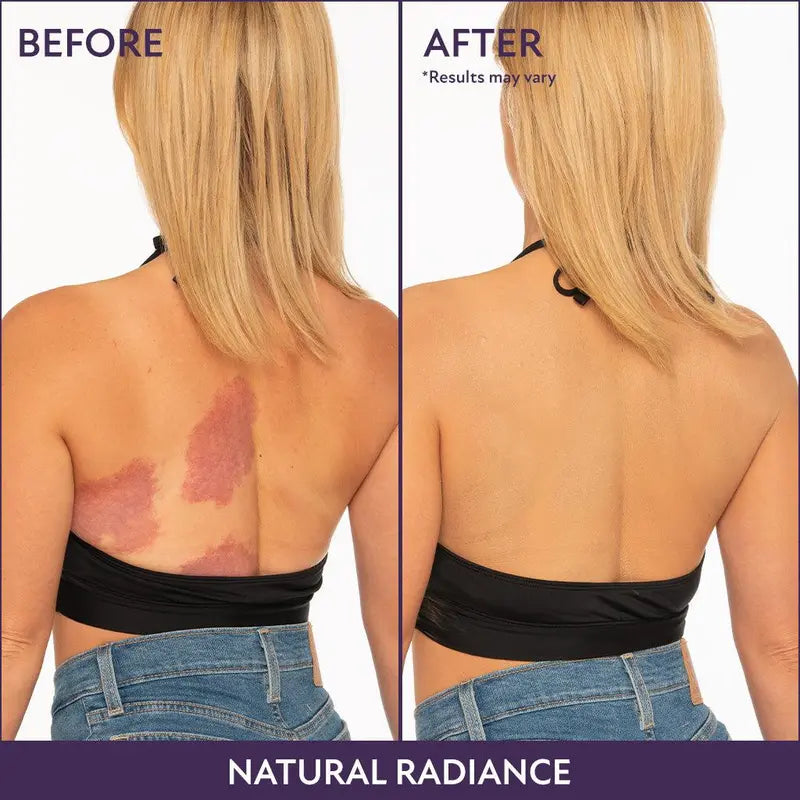 💞Buy 1 Get 1 Free!💜✨Body Coverage Perfector – Waterproof, Lightweight & Flawless Body Makeup