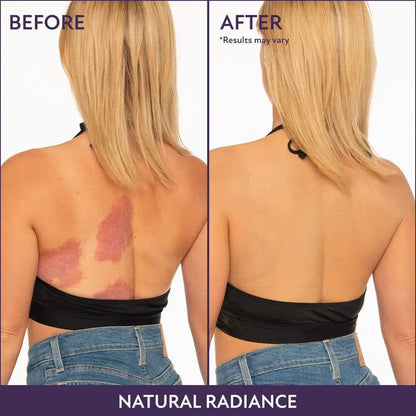 💞Buy 1 Get 1 Free!💜✨Body Coverage Perfector – Waterproof, Lightweight & Flawless Body Makeup