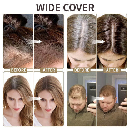 💇‍♀️✨2026 Hot Sale -Buy 1 Get 1 Free💋New Upgraded Magic Root Cover Up Hairline Powder