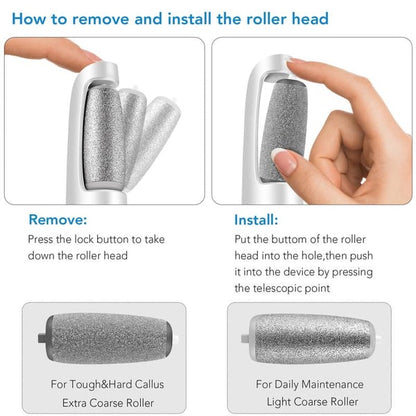 🔥Mother's Day Hot Sale 50%🔥⚡Electric Feet Callus Remover