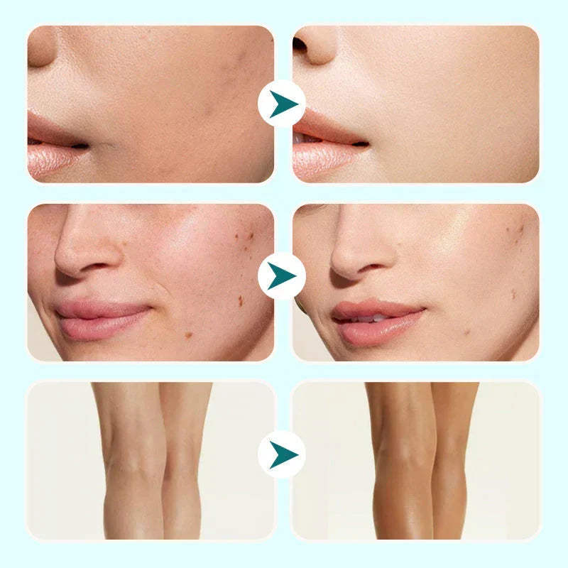 🔥Último día: ¡Compra 1 y llévate 1 GRATIS!🎁Hidratante, corrector y cobertura todo en uno 💧✨ Ligero y resistente al agua