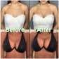 🔥LAST DAY SALE ONLY ￡7.99!!💕OUFALI Lift Inserts for Bras – Lightly Padded, Double-Sided Adhesive👙 Reusable, Washable • Natural Lift • Seamless Under Clothing ✨