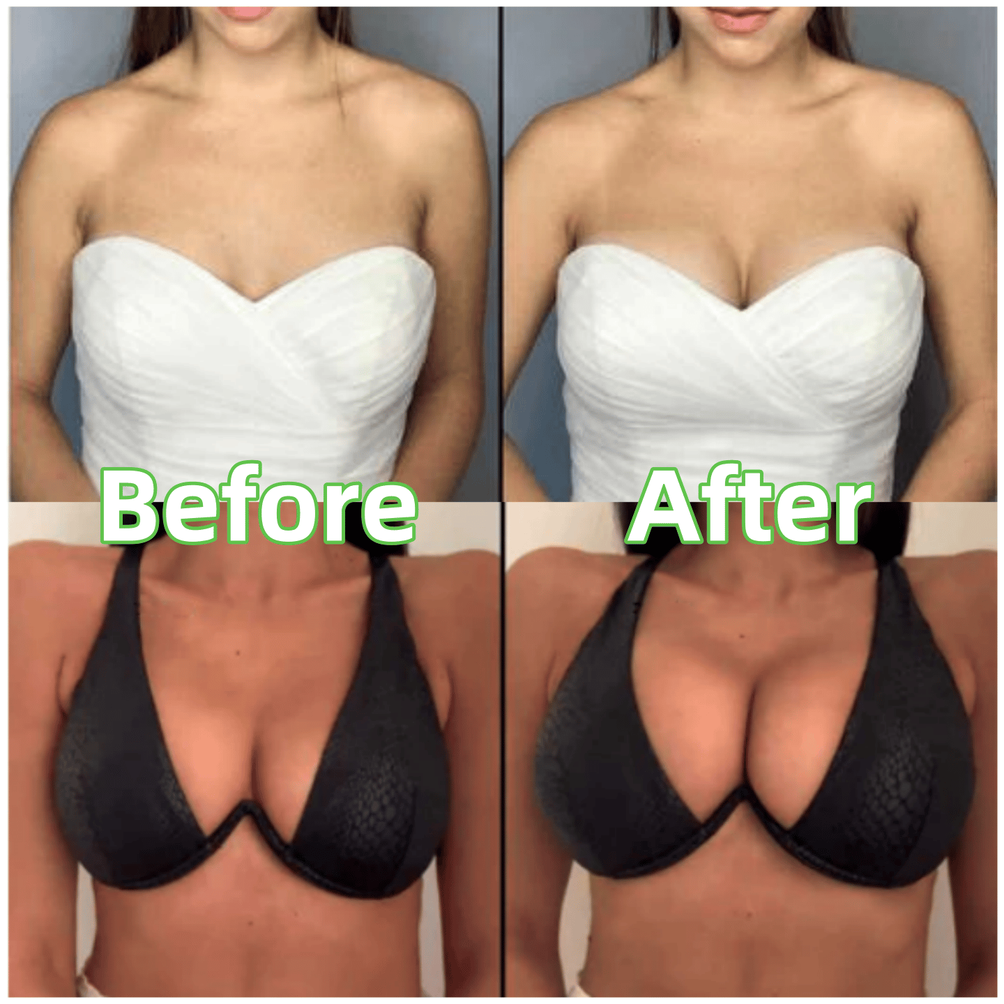 🔥LAST DAY SALE ONLY ￡7.99!!💕OUFALI Lift Inserts for Bras – Lightly Padded, Double-Sided Adhesive👙 Reusable, Washable • Natural Lift • Seamless Under Clothing ✨