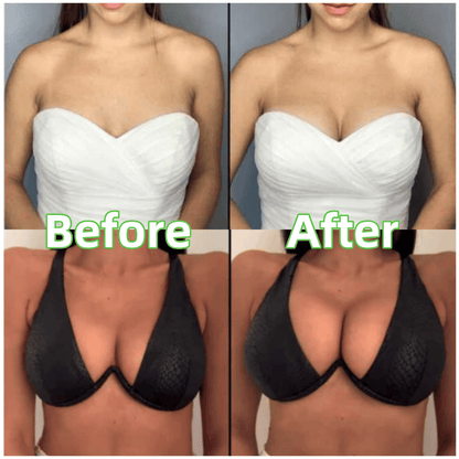 🔥LAST DAY SALE ONLY ￡7.99!!💕OUFALI Lift Inserts for Bras – Lightly Padded, Double-Sided Adhesive👙 Reusable, Washable • Natural Lift • Seamless Under Clothing ✨