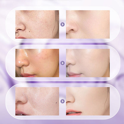 ⚡Hot Sale 50% OFF 🔥🎉All-in-One Niacinamide Cream