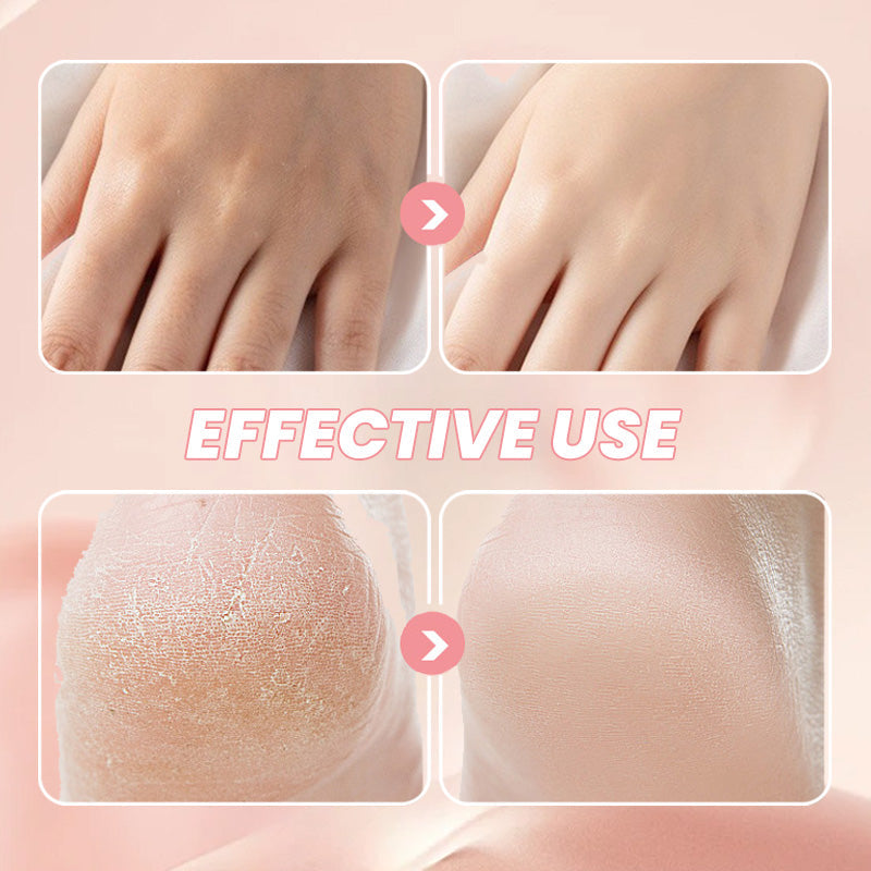 Moisturizing and Anti-Cracking Ointment Stick