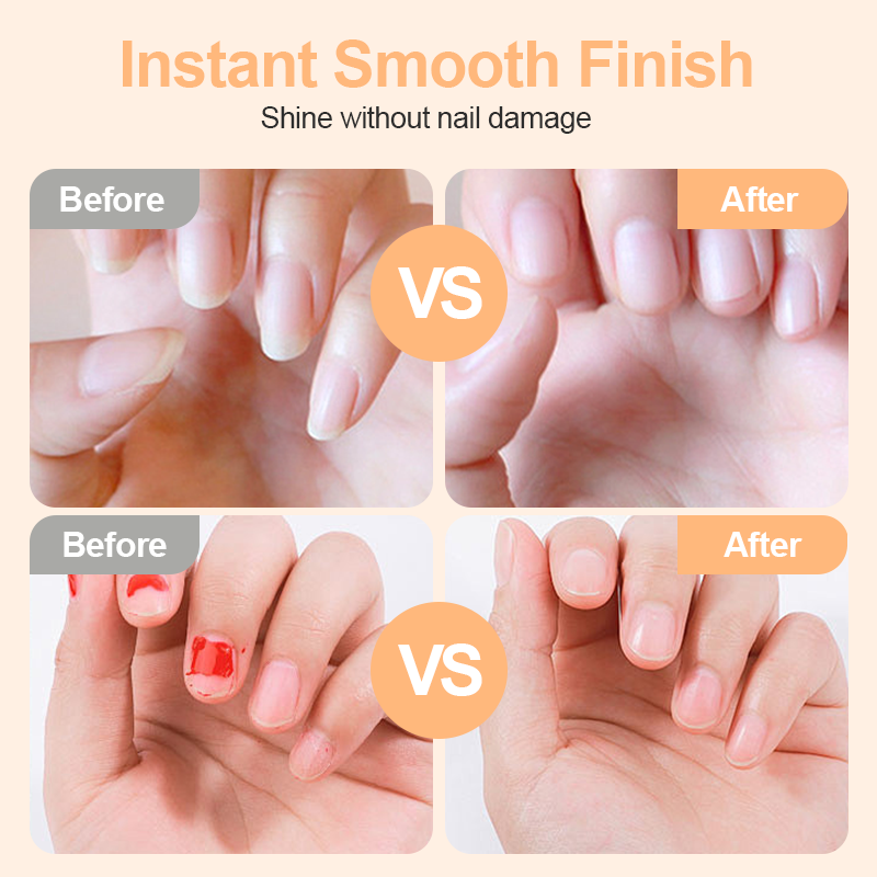 💗LAST DAY SALE 49% OFF💕🌟2-in-1 Safe Electric Nail Clipper