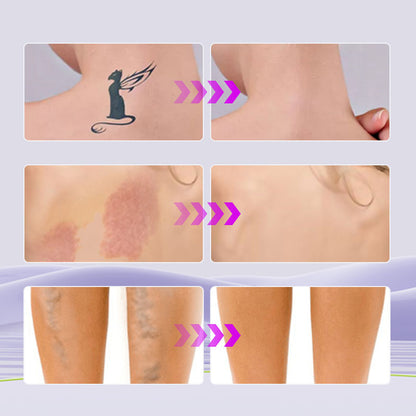 💞Buy 1 Get 1 Free!💜✨Body Coverage Perfector – Waterproof, Lightweight & Flawless Body Makeup