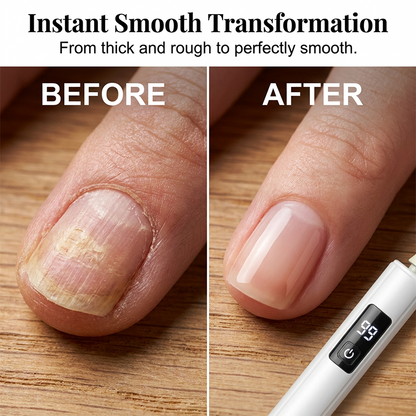 🥳2026 HOT SALE💞✨ 50% OFF! Professional Electric Nail Polisher – Smooths thick nails, 99-speed display. Multiple heads for shaping & buffing. Salon at home! 🌟💎